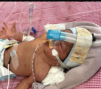 Baby of Shaikh Irfan Moinuddin
